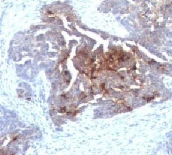 TAG-72 Antibody