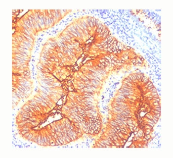 TAG-72 Antibody