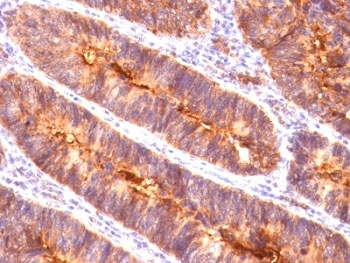 MUC1 Antibody / Mucin-1