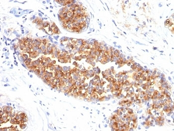 MUC1 Antibody / Mucin-1