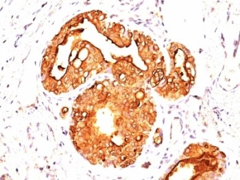 MUC1 Antibody / Mucin-1