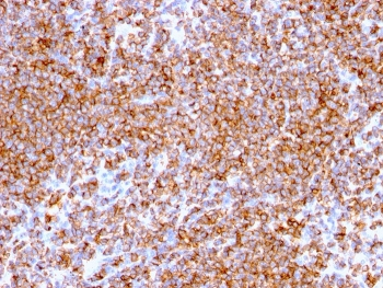 CD20 Antibody