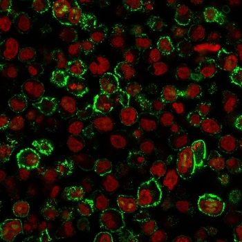 CD20 Antibody