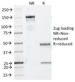 CD20 Antibody