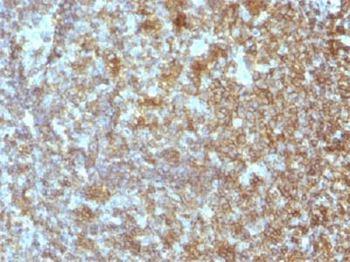 CD45RA Antibody (Leukocyte marker)
