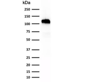 Cadherin 16 Antibody