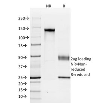 Cadherin 16 Antibody