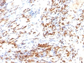 p27 Antibody Cocktail