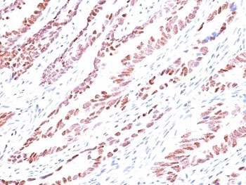p57 Antibody