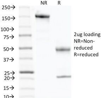 p57 Antibody