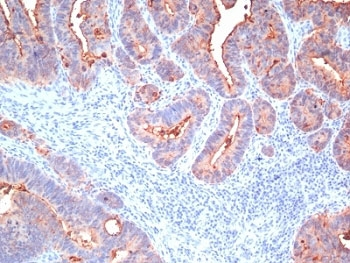 Pan-CEA Antibody Cocktail / CEACAM5