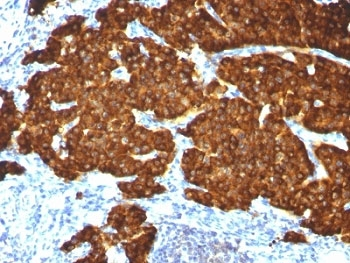 Chromogranin A Antibody Cocktail