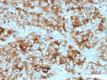Chromogranin A Antibody Cocktail