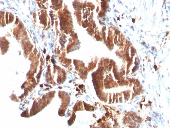 TOP1MT Antibody / Topoisomerase I mitochondrial