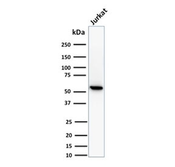 TOP1MT Antibody / Topoisomerase I mitochondrial