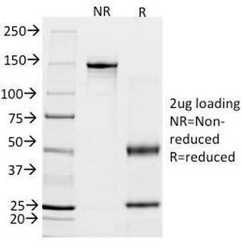 Calponin 1 Antibody