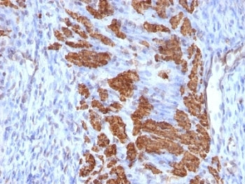 Calponin Antibody Cocktail