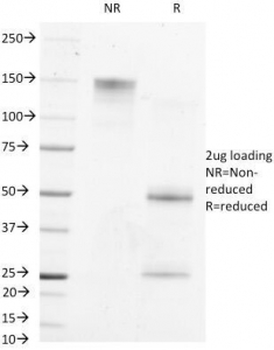 Alpha Fetoprotein / AFP Antibody