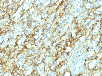 Fibronectin Antibody