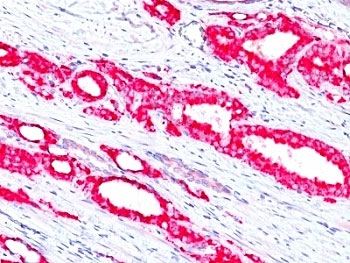 AMACR / p504S Antibody (Prostate Cancer Marker)