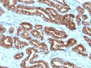 AMACR / p504S Antibody (Prostate Cancer Marker)