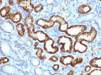 AMACR / p504S Antibody (Prostate Cancer Marker)