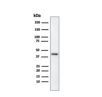 AMACR / p504S Antibody (Prostate Cancer Marker)