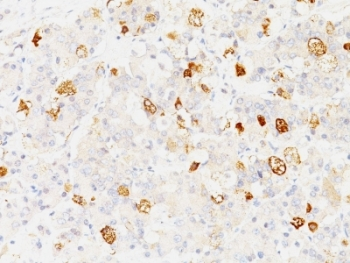 FSH-beta Antibody