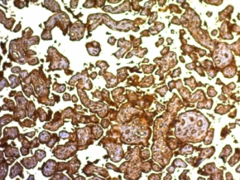 PLAP Antibody / Placental Alkaline Phosphatase
