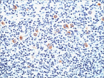 SSEA-1 Antibody