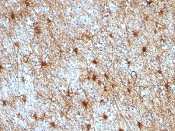 GFAP Antibody / Glial Fibrillary Acidic Protein Cocktail