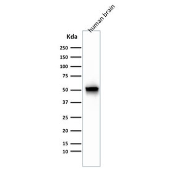 GFAP Antibody / Glial Fibrillary Acidic Protein Cocktail