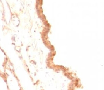 Glypican 3 Antibody / GPC3