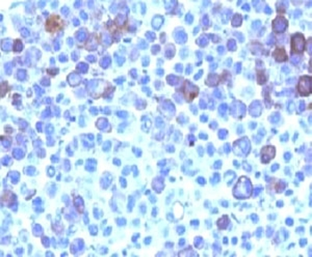 Glypican 3 Antibody / GPC3