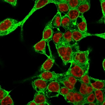 Glypican 3 Antibody / GPC3