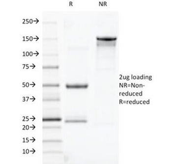 TOX3 Antibody