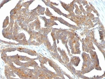 GnRH Receptor Antibody