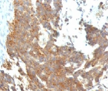 GnRH Receptor Antibody