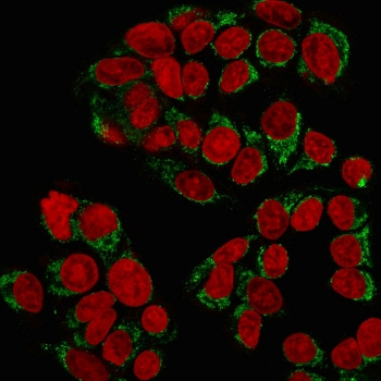 GnRH Receptor Antibody
