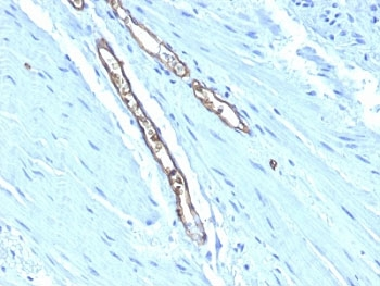 ABO Antibody / Blood Group Antigen A