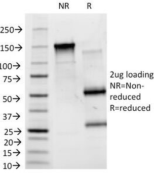 ABO Antibody (Blood Group Antigen B)