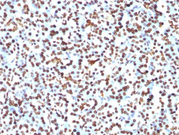 Histone Antibody / Histone H1