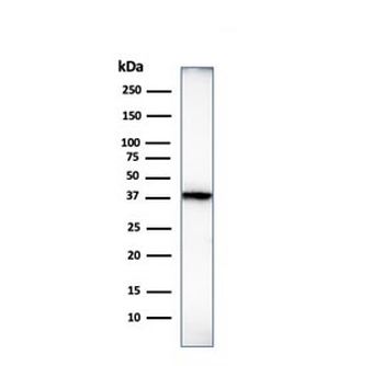 Histone Antibody / Histone H1