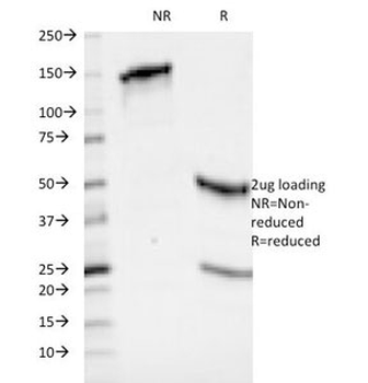 HLA-ABC Antibody (MHC I)