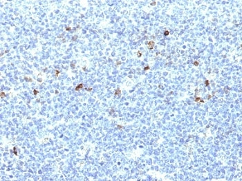 HLA-A25 Antibody (HLA-Aw32)