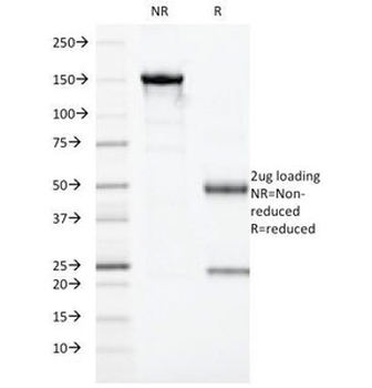HLA-DR Antibody (MHC II)