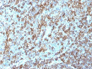 HLA-DR Antibody (MHC II)