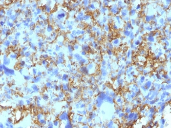 HLA-DR Antibody (MHC II)