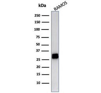 HLA-DR Antibody (MHC II)