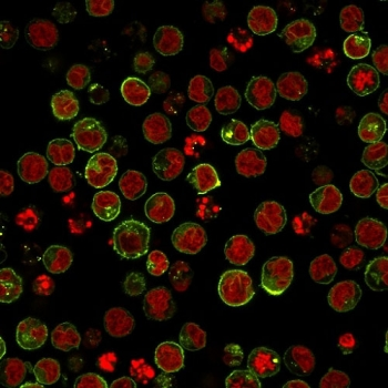 HLA-DRB1 Antibody (MHC II)